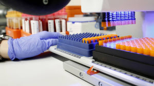 Haluatko antaa näytteen biopankkiin? Mitä näytteellä tehdään?