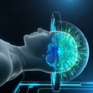 3d-illustration av hur fokuserat ultraljud mot hjärnan fungerar.