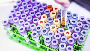 Biobankerna har samlat in blodprover från nästan en halv miljon finländare. Flaskor med blodprover.
