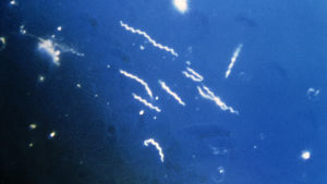 Korkskruvsformad Borrelia burgdorferi Borrelia burgdorferi bakterier