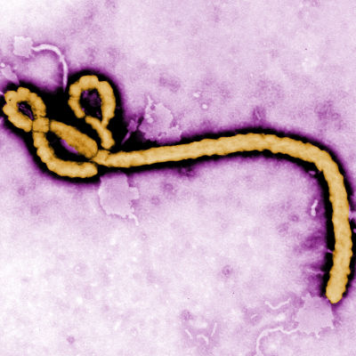 Ebolaviruset