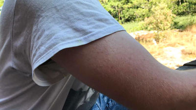 Emil i kortärmad skjorta där överarmens muskel är fotograferad i närbild