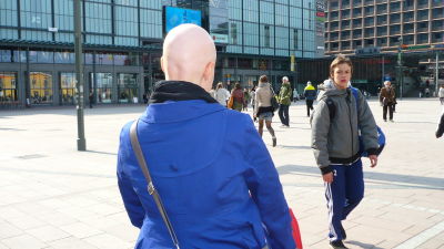 En helt hårlös person skiljer sig ur mängden och får ofta nyfikna blickar. Bild: Yle/Ingela West