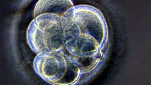 Ett tre dagar gammalt klonat embryo vid Centre for life i Newcastle 2005. Tre dagar gammalt klonat embryo