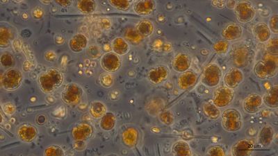 Dinoflagellater från Ersö fotade via ett mikroskop.