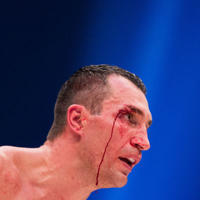 Volodymyr Klytjko, i matchen mot Tyson Fury, november 2015.