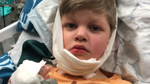 Damian Nylund på sjukhus efter olyckan på förskolan. En pojke med tårar i ögonen och bandage på huvudet ser in i kameran.