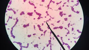 Clostridium botulinum bakteeria maljalla