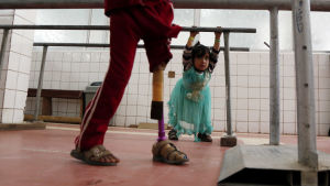På tre år har över 6 500 barn dött eller skadats i kriget i Jemen, enligt UNICEF. På bilden provar kusinerna Hala och Aradah proteser i ett rehabiliteringscenter i huvudstaden Sanaa. I förgrunden kan man se ett barn med ett protesben. I bakgrunden en liten flicka i ljusblå klänning.