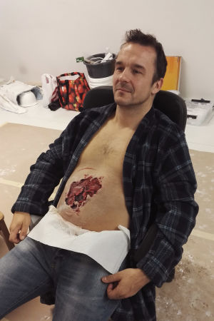 Ilja Peltonen istuu penkillä. Hänen vatsaansa on maskeerattu suuri verinen jälki.