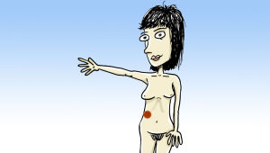 Det typiska stället för gallstenssmärtor är under höger revbensbåge. Illustration: Yle/Mikael Lehtelä Här gör det ont vid ett gallstensanfall. Smärtan kan också stråla ut mot ryggen eller upp mot höger axel.
