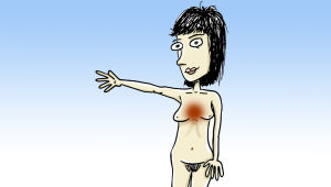 Reflux kan förorsaka bröstsmärta. Illustration: Yle/Mikael Lehtelä. Bröstsmärta