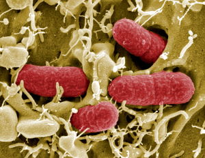 EHEC-bakteereja, Helmholtz Centre for Infection Research
