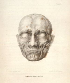 Mitä hänen mielessään liikkuu? Kuvitusta Charles Bellin kirjassa Essays on the Anatomy of Expression in Painting (1806). Piirros kasvoista. Tekijä: Bell, Charles. Essays on the Anatomy of Expression in Painting; The muscles of the face.
