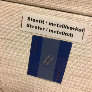 En stent lades in utan att Heidi ens hann uppfatta det. En blå platta med en stent på. Stenten är rund och gjord av ett tunt metallnät.