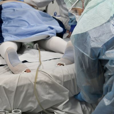 Vårdare i blå skyddsdräkter vänder på en coronapatient på intensivvårdsavdelningen.