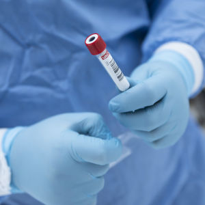 Suojavarusteisiin pukeutunut henkilö pitelee koeputkea käsissään. 