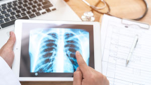 Datorprogram kan i framtiden till exempel allt oftare hjälpa läkare med att diagnostisera patienter. Läkare använder surfplatta.