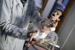 Efter bilderna på Sahar Dofdaa som dog som en månad gammal av svält i Ghouta har myndigheterna slagit larm om att flera andra barn kan komma att gå samma öde till mötes. Svältande barn i Ghouta i Syrien.