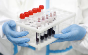 Nu ska coronapatienterna på Island undersökas för antikroppsnivåer igen. Också de långvariga symptomen ska kartläggas. Närbild på blodprovstuber, en person med vit laboratorierock och blå plasthandskar håller i dem.