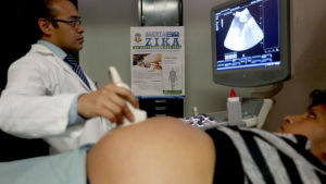 Forskare tror att det finns ett samband mellan zikasmitta hos gravida och mikrocefali hos fostret. gravid kvinna undersöks