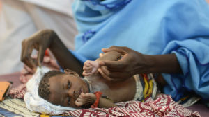 FN:s mål är att få slut på den extrema fattigdomen i världen till år 2030. Planen räknar ändå med högre biståndsnivåer. Ett undernärt barn i Senegal.