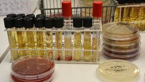 Mikrobiologiska prov underöks. Kuvassa laboratorion näyteputkia ja -astioita