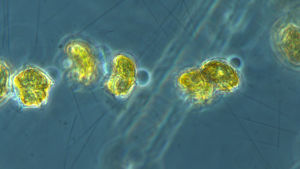 De här algerna kan bara ses i mikroskop. mikroskopbild av plankton