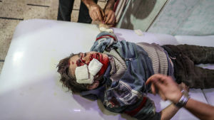 Ett sårat barn vårdas på en klinik i Douma på lördagen. Ett sårat barn vårdas på kliniken i Douma på lördagen.