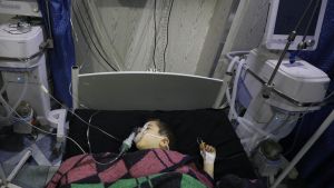 En humanitär katastrof som pågår i det tysta. Ett syriskt barn som vårdas på ett sjukhus i Ariha i provinsen Idlib efter att ha skadats i en flygattack. Ett syriskt barn som skadats vid en flygräd. Barnet vårdas på ett sjukhus i Ariha i provinsen Idlib. 30.1.2020.