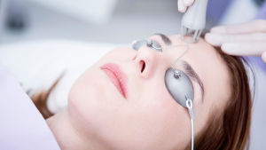 En kvinna som blir behandlad med koldioxidlaser. Hon ligger på en brits och har på sig små solglasögon. Lasern ser ut som ett vitt rör.