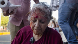   Famous activist Ana Quiroz was bloody during the first days of protests. Violence against protesters swelled protests 