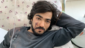 En man vårdas på sjukhus för sina splitterskador. Han hör till de över 30 personer som skadades när en bilbomb exploderade vid ett valmöte den 17 september i staden Charikar. Talibanerna låg bakom bomben som dödade minst 24 personer. En man som skadats vårdas på sjukhus i närheten av Kabul i Afghanistan. Mannen skadades efter att en bilmomb detonerat vid ett valmöte i utankanten av Kabul.