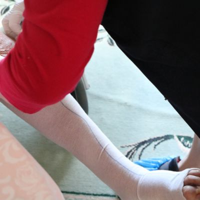 En hemvårdare lägger på en stödstrumpa på en klients vänsta fot.