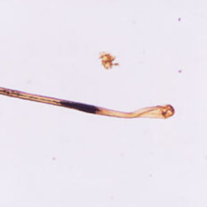 Mikroskopbild på hårstrå.