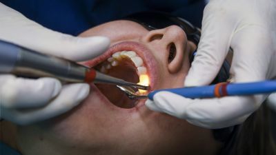 tandläkare undersöker mun