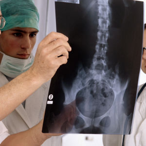 Lääkärit tutkivat röntgenkuvaa