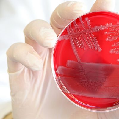 Laboratoriotyöntekijä pitelee viljeltyä EHEC-bakteerikantaa sisältävää petrimaljaa.