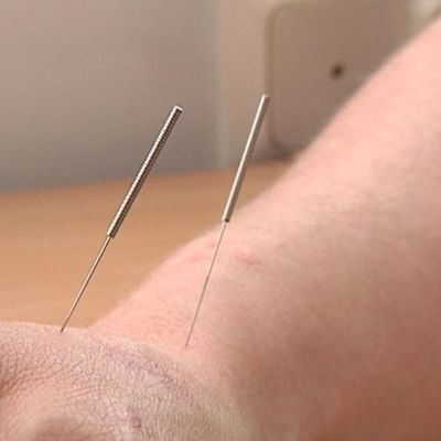 Akupunktio Uusimmat Sisallot Yle Fi