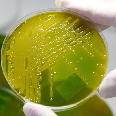 Laboratoriotyöntekijä vertailee keltavihreitä EHEC-bakteeripesäkkäitä petrimaljoissa.