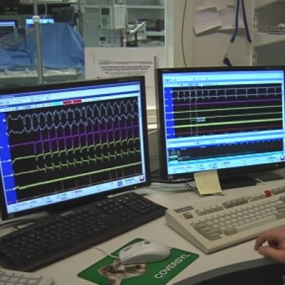 Kuopion yliopistollisen sairaalan rytmihäiriölaboratorio