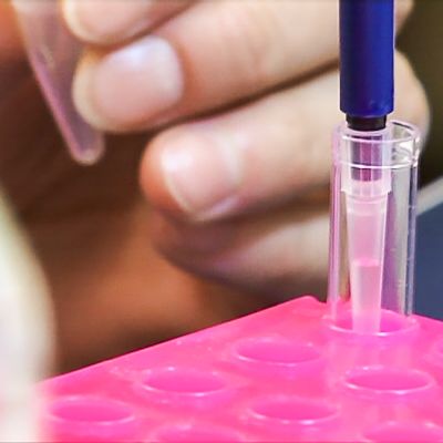 syöpähoito immunoterapia koeputki laboratorio