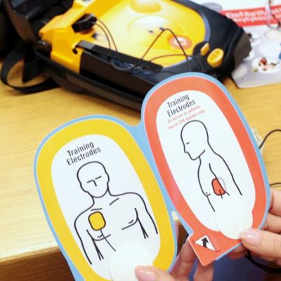 Defibrillaattorin elektrodeja havaintokuvineen.