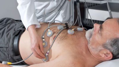 EKG