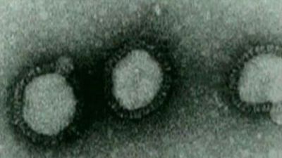 Viruset sett genom ett mikroskop