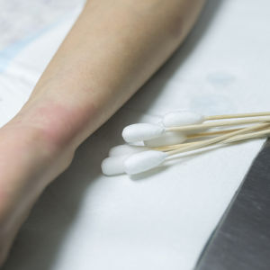 Kosmetiikan säilöntäaineet lisäävät allergiariskiä.