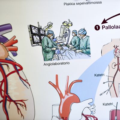 Pallolaajennusinfotaulu on Astra Zenecan tekemä.