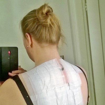 Kati Kristiina Mouhulla testataan, mille kaikille aineille hän on herkistynyt tai allergisoitunut.