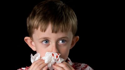 varför blöder man näsblod
