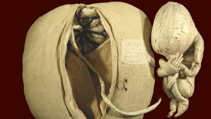 Under 1700-talets upplysningstid blev barnmorskor akademiskt skolade inom anatomi och obstetrik, den första vetenskapliga läran om förlossningar och graviditeter. En anatomisk modell från 1700-talets senare hälft av en kvinnas livmoder och ett foster, med navelsträng.